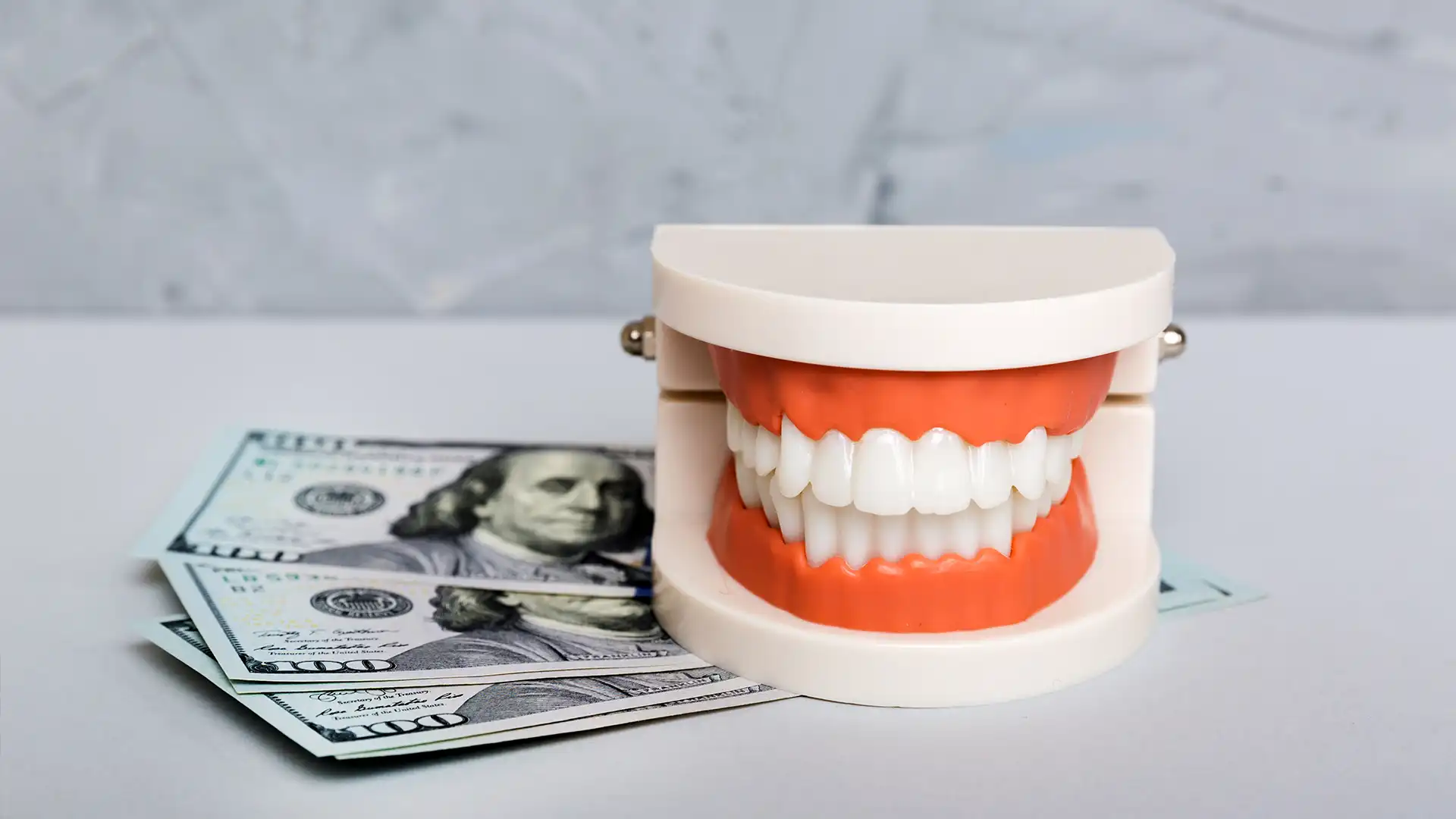 tooth replacement cost turkey​